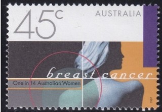 乳がん.オーストラリア.1997.jpg